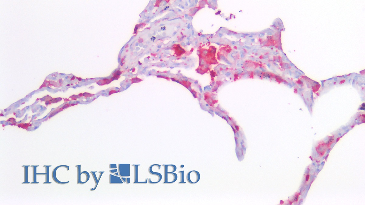 Polyclonal Antibody to Ferritin, Light Polypeptide (FTL)