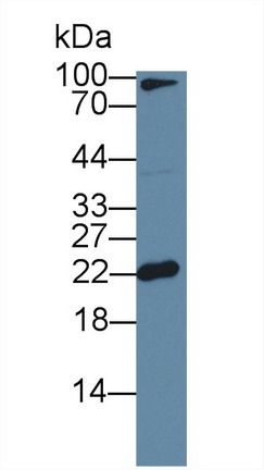 Polyclonal Antibody to Ferritin, Light Polypeptide (FTL)