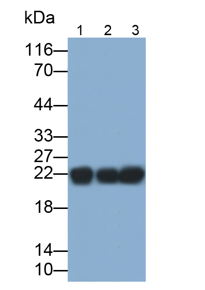 Polyclonal Antibody to Ferritin, Heavy Polypeptide (FTH)