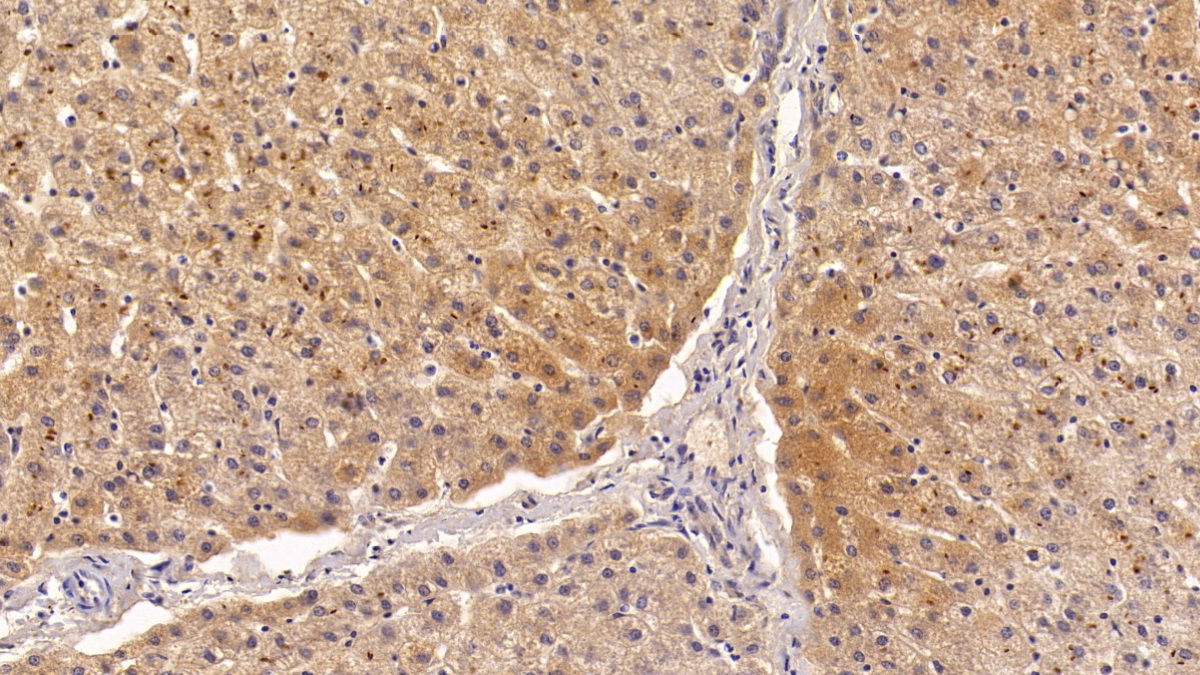 Polyclonal Antibody to Ferritin, Heavy Polypeptide (FTH)