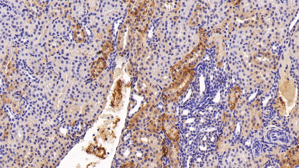 Polyclonal Antibody to Ferritin, Heavy Polypeptide (FTH)