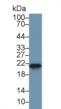 Polyclonal Antibody to Ferritin, Heavy Polypeptide (FTH)