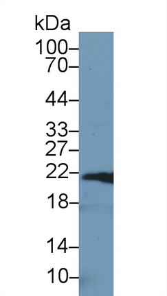 Polyclonal Antibody to Ferritin, Heavy Polypeptide (FTH)