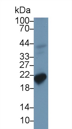 Polyclonal Antibody to Ferritin, Heavy Polypeptide (FTH)