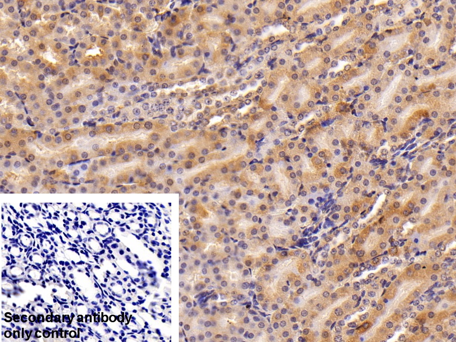 Polyclonal Antibody to Ferritin, Heavy Polypeptide (FTH)