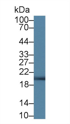 Polyclonal Antibody to Ferritin, Heavy Polypeptide (FTH)