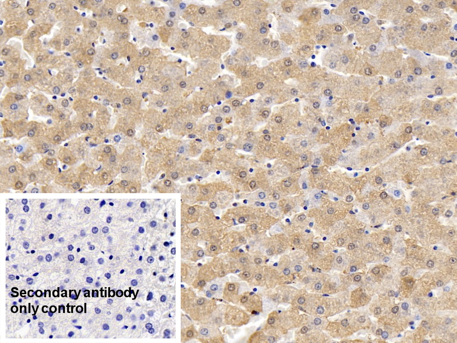 Polyclonal Antibody to Ferritin, Heavy Polypeptide (FTH)