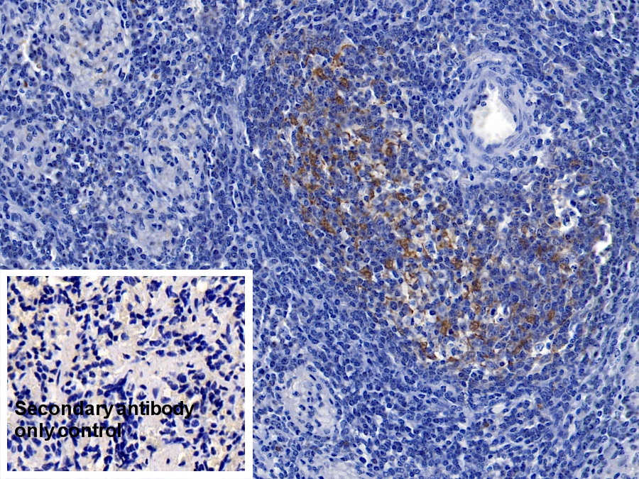 Polyclonal Antibody to Ferritin, Heavy Polypeptide (FTH)