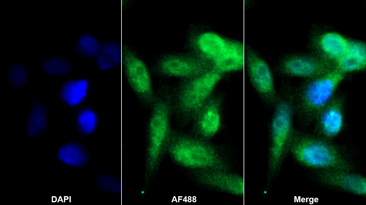 Polyclonal Antibody to Ferritin, Heavy Polypeptide (FTH)