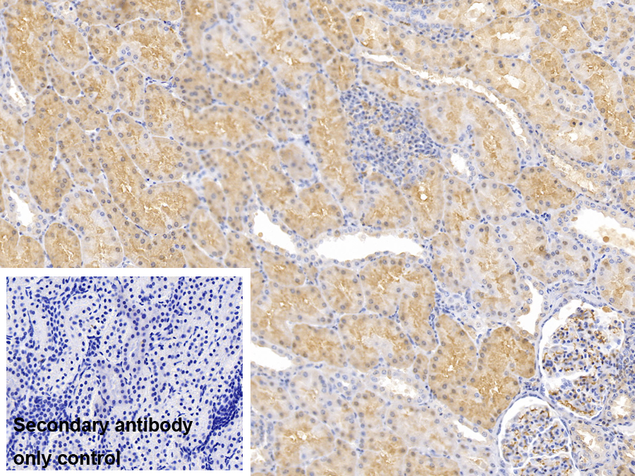 Polyclonal Antibody to Ferritin, Heavy Polypeptide (FTH)