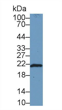 Polyclonal Antibody to Ferritin, Heavy Polypeptide (FTH)