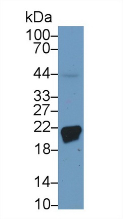 Polyclonal Antibody to Ferritin, Heavy Polypeptide (FTH)