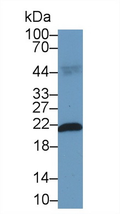 Polyclonal Antibody to Ferritin, Heavy Polypeptide (FTH)