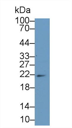 Polyclonal Antibody to Ferritin, Heavy Polypeptide (FTH)