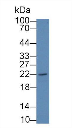 Polyclonal Antibody to Ferritin, Heavy Polypeptide (FTH)