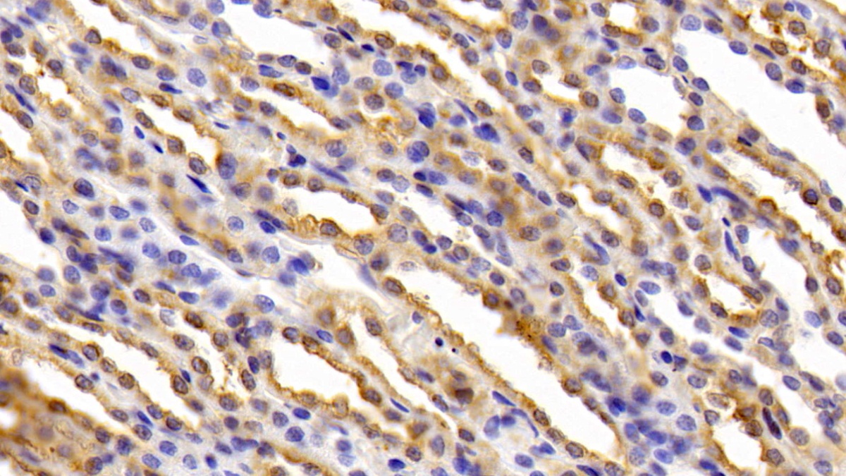 Polyclonal Antibody to Ferritin, Heavy Polypeptide (FTH)