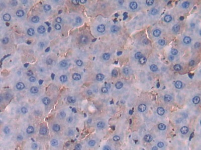 Polyclonal Antibody to Fibrinogen Like Protein 1 (FGL1)