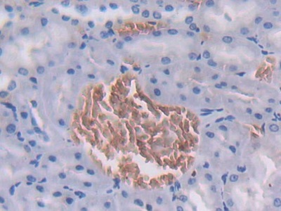 Polyclonal Antibody to Fibrinogen Like Protein 1 (FGL1)