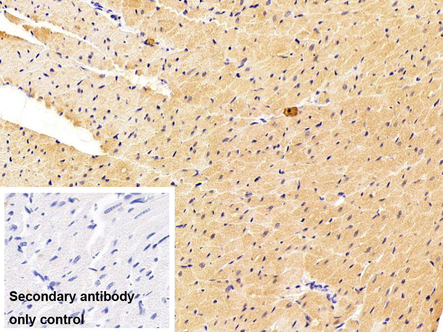 Polyclonal Antibody to Ryanodine Receptor 2, Cardiac (RYR2)