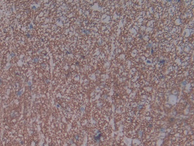 Polyclonal Antibody to Natriuretic Peptide Receptor 3 (NPR3)