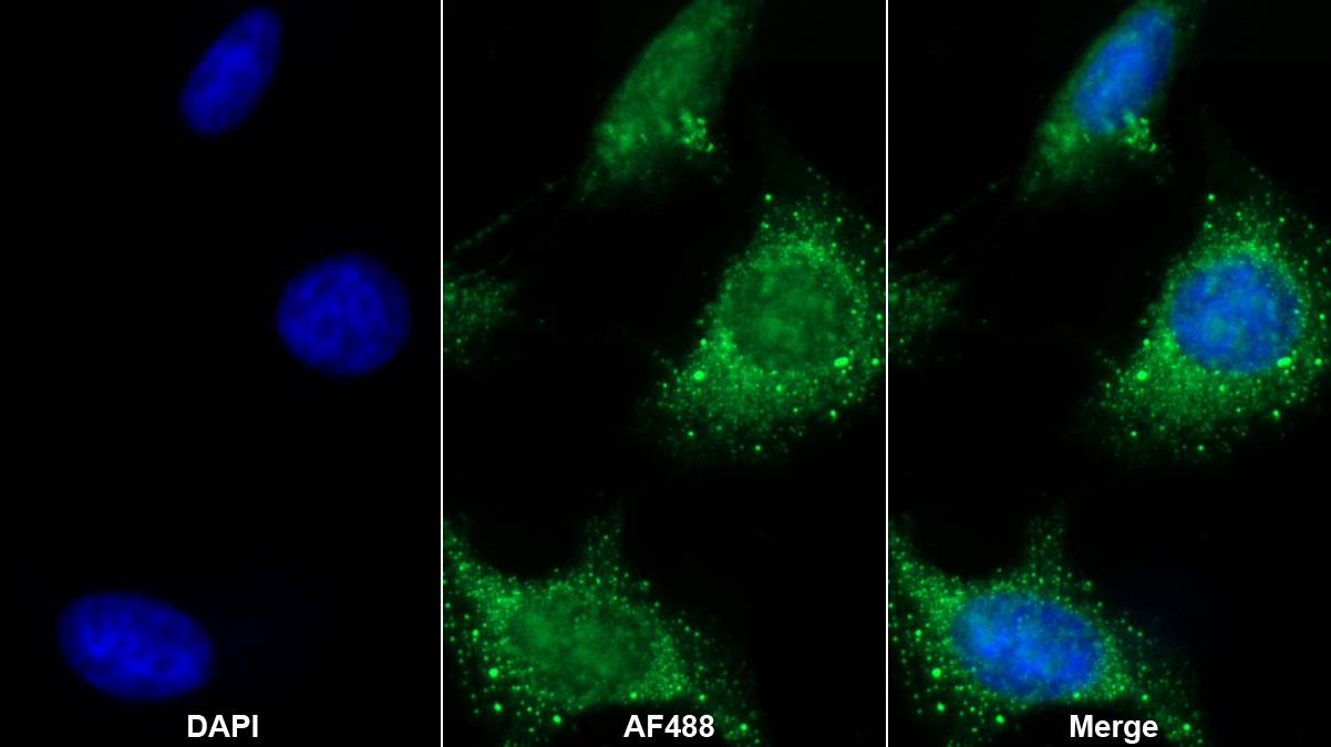 Polyclonal Antibody to Heat Shock 70kDa Protein 2 (HSPA2)