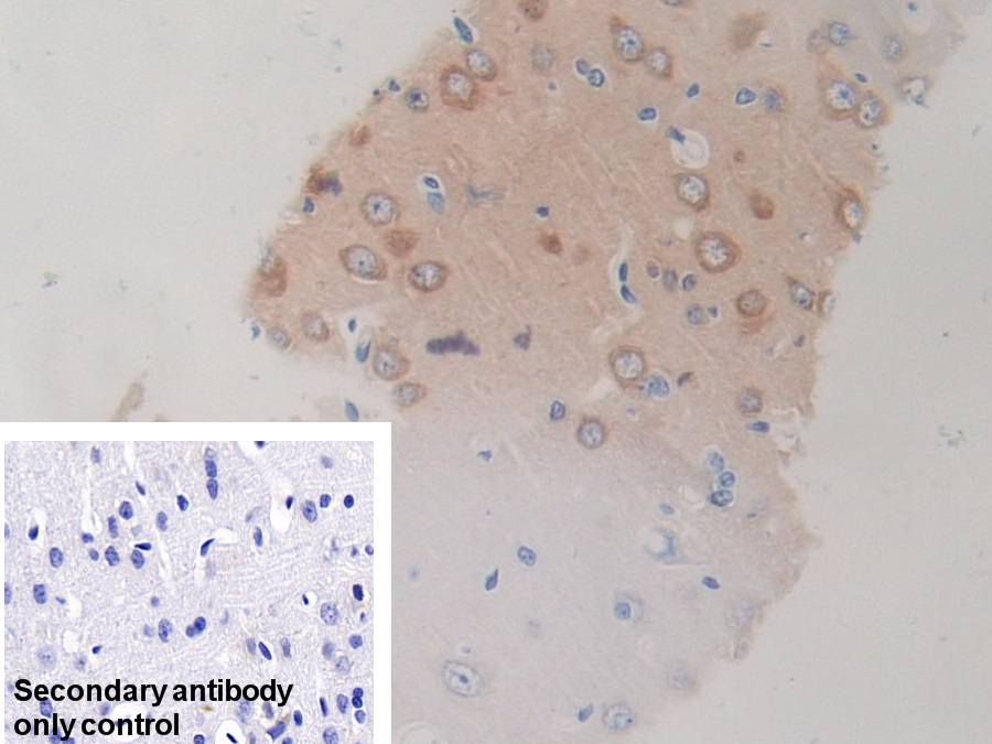 Polyclonal Antibody to Heat Shock 70kDa Protein 8 (HSPA8)