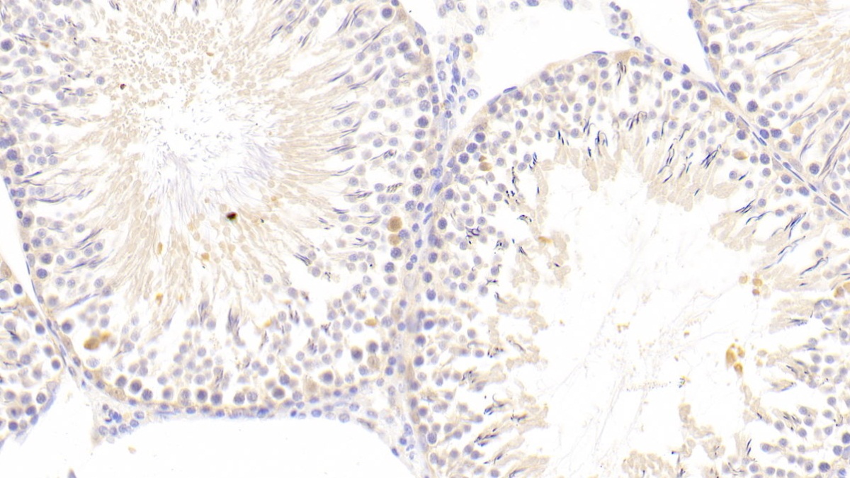 Polyclonal Antibody to Apelin (APLN)