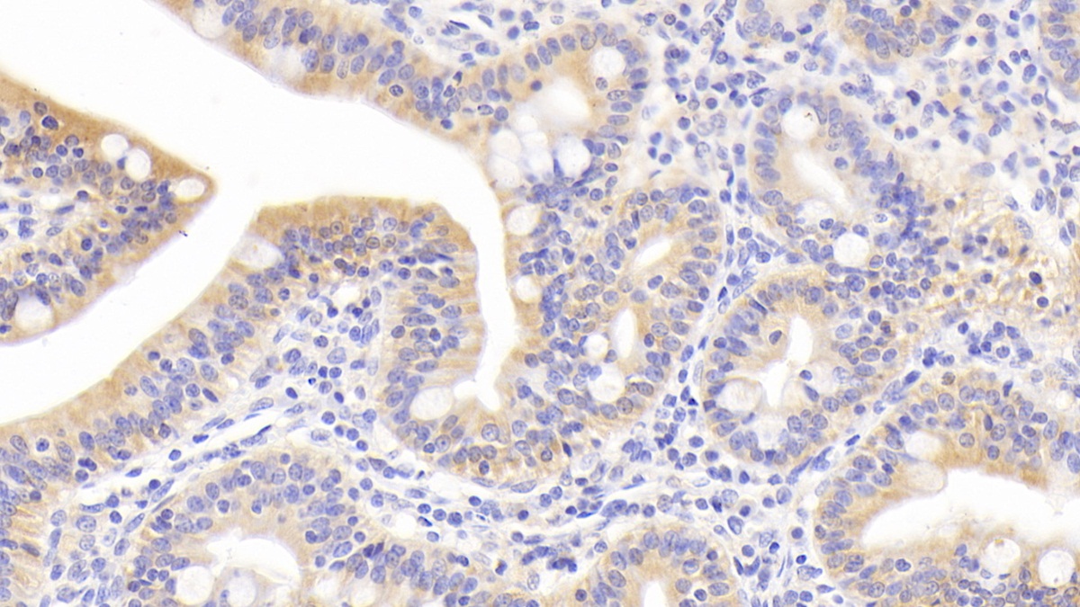 Polyclonal Antibody to Membrane Protein, Palmitoylated 3 (MPP3)