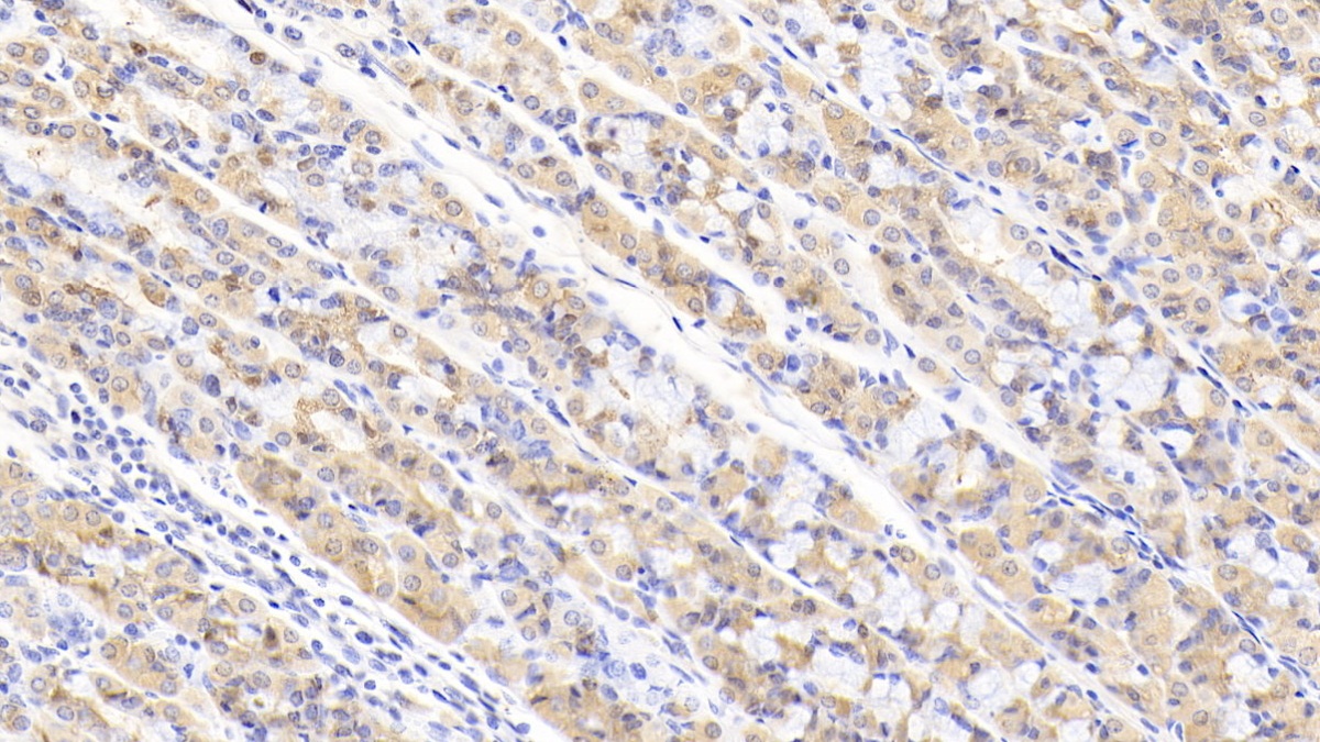 Polyclonal Antibody to Membrane Protein, Palmitoylated 3 (MPP3)