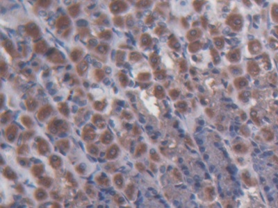 Polyclonal Antibody to Membrane Protein, Palmitoylated 3 (MPP3)