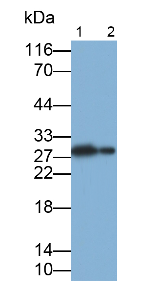 Polyclonal Antibody to Carbonic Anhydrase III, Muscle Specific (CA3)