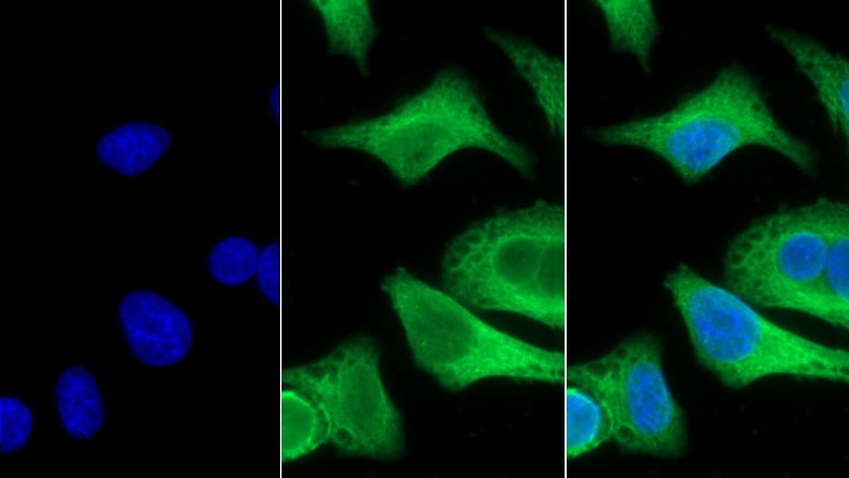 Polyclonal Antibody to Carbonic Anhydrase IV (CA4)