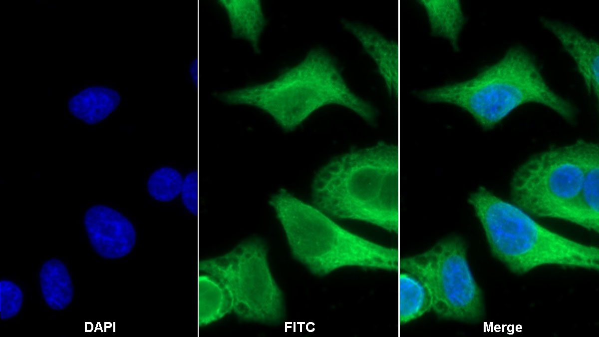 Polyclonal Antibody to Carbonic Anhydrase IV (CA4)