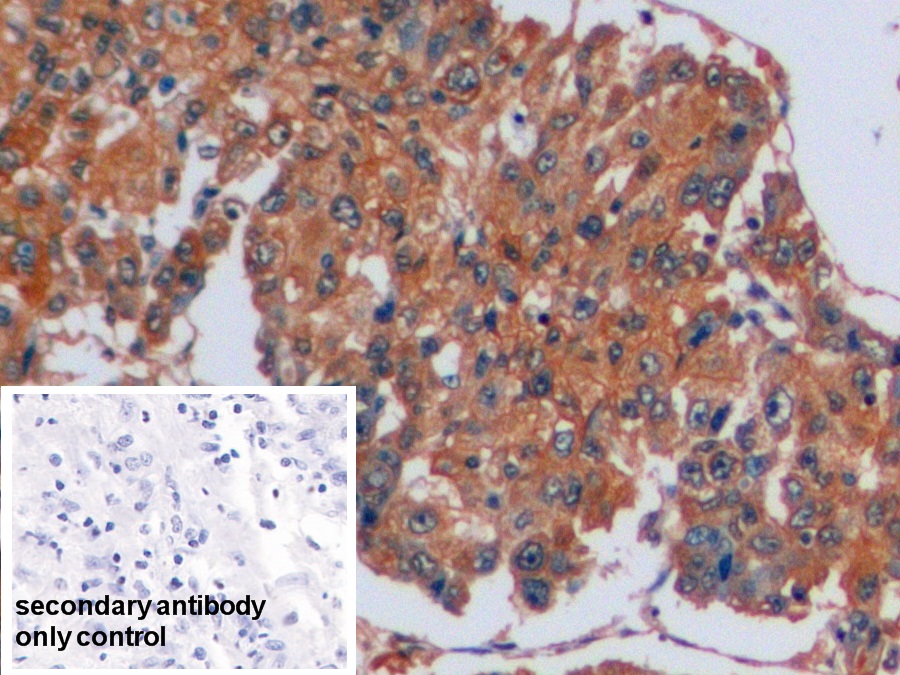 Polyclonal Antibody to Carbonic Anhydrase IX (CA9)