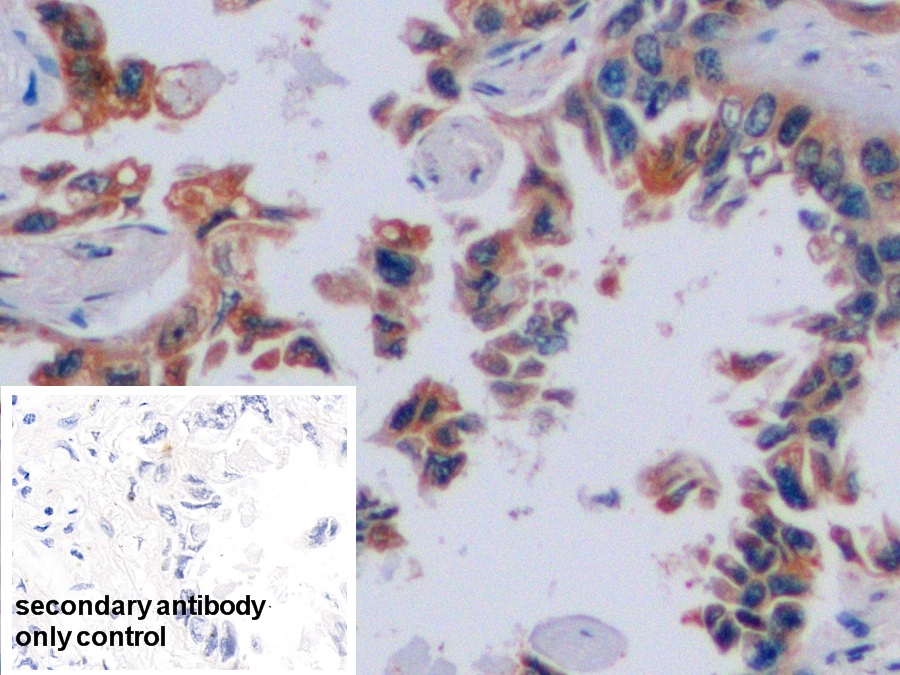 Polyclonal Antibody to Carbonic Anhydrase IX (CA9)