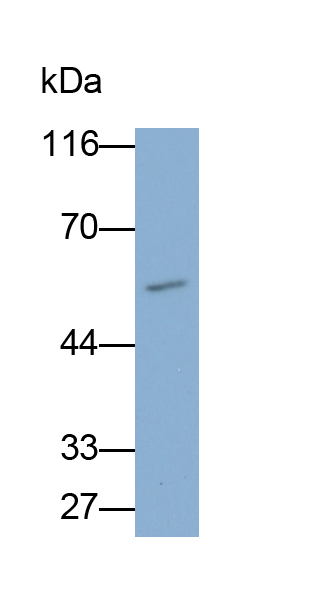 Polyclonal Antibody to Carbonic Anhydrase IX (CA9)