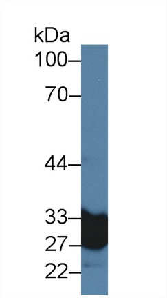 Polyclonal Antibody to Carbonic Anhydrase VA (CA5A)