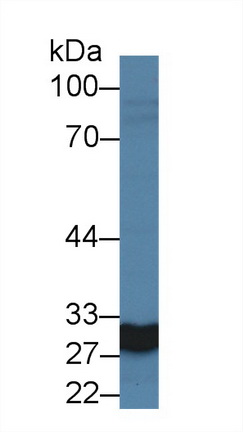 Polyclonal Antibody to Carbonic Anhydrase VA (CA5A)