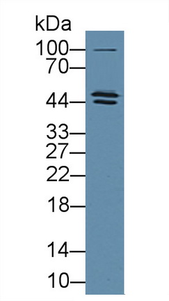 Polyclonal Antibody to Acid Phosphatase 6, Lysophosphatidic (ACP6)