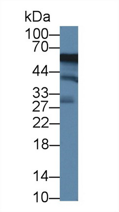 Polyclonal Antibody to Acid Phosphatase 6, Lysophosphatidic (ACP6)