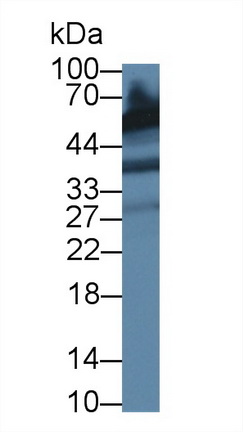 Polyclonal Antibody to Acid Phosphatase 6, Lysophosphatidic (ACP6)