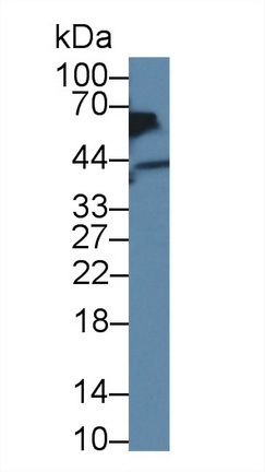 Polyclonal Antibody to Acid Phosphatase 6, Lysophosphatidic (ACP6)