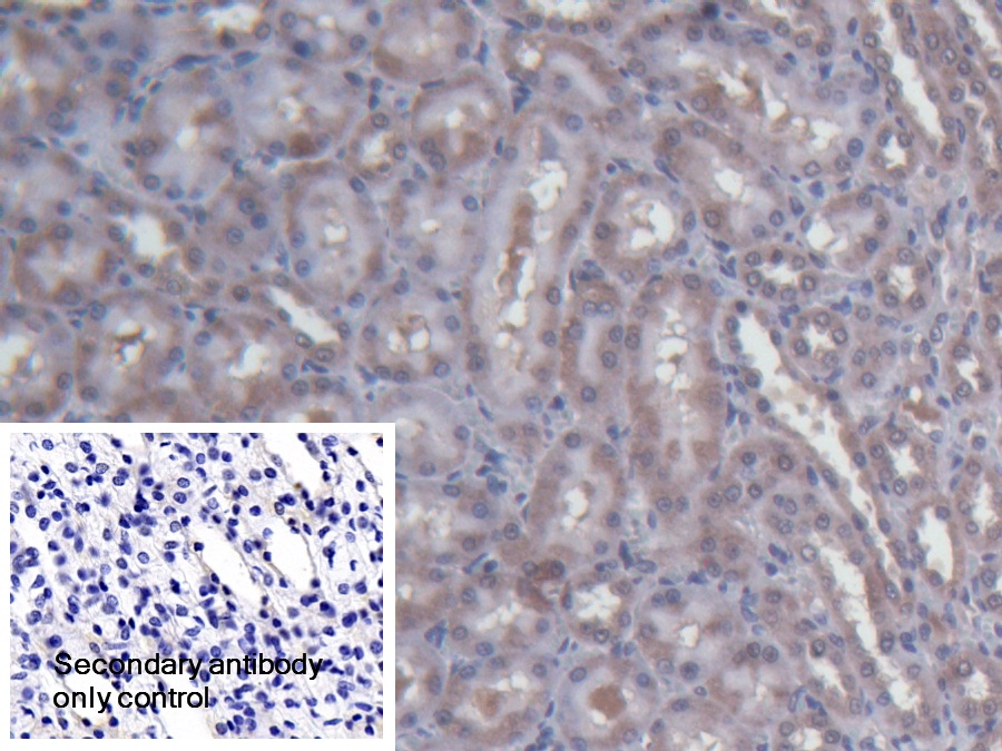 Polyclonal Antibody to Acid Phosphatase 6, Lysophosphatidic (ACP6)