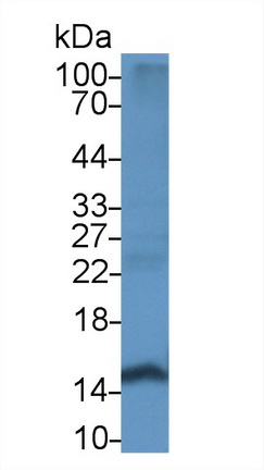 Polyclonal Antibody to Hemoglobin Alpha 1 (HBa1)