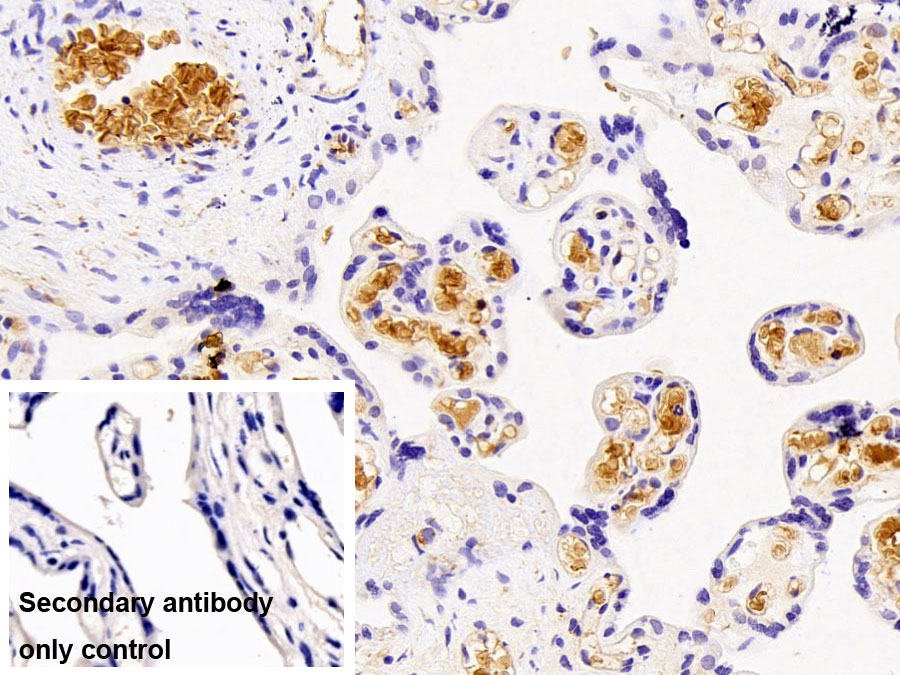 Polyclonal Antibody to Hemoglobin Alpha 1 (HBa1)