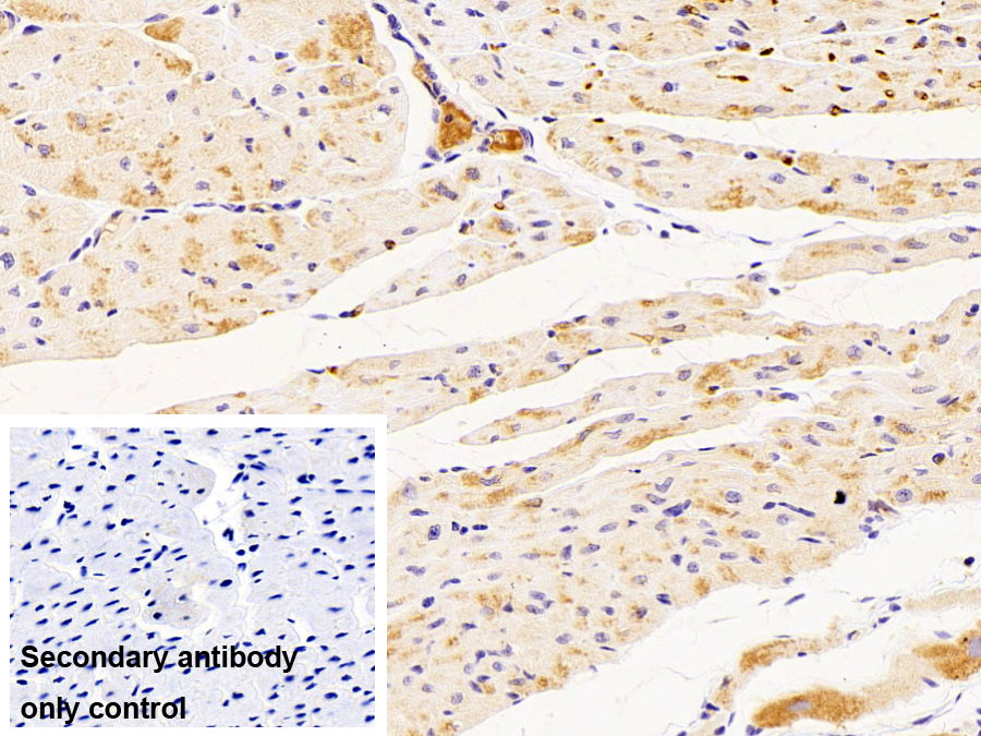 Polyclonal Antibody to Hemoglobin Alpha 1 (HBa1)