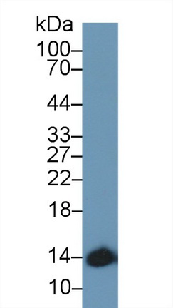 Polyclonal Antibody to Hemoglobin Alpha 1 (HBa1)