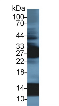 Polyclonal Antibody to Hemoglobin Alpha 1 (HBa1)