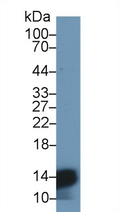 Polyclonal Antibody to Hemoglobin Alpha 1 (HBa1)