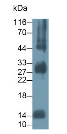 Polyclonal Antibody to Hemoglobin Alpha 1 (HBa1)